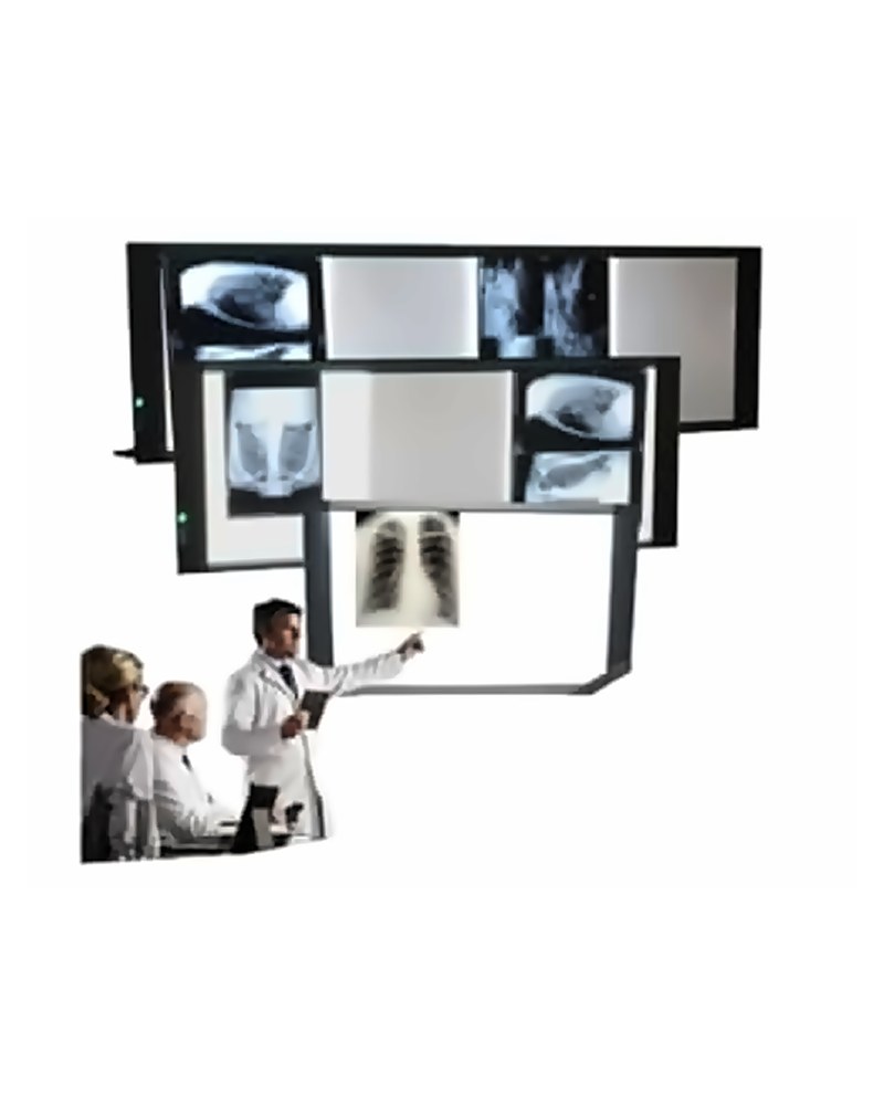 Négatoscope extra-plat LED